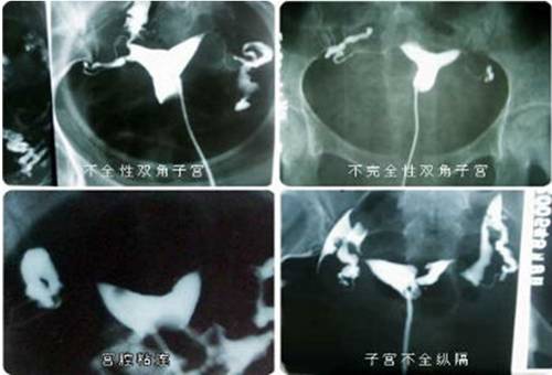 ��̬���ֻ��ӹ����ѹ���Ӱ����