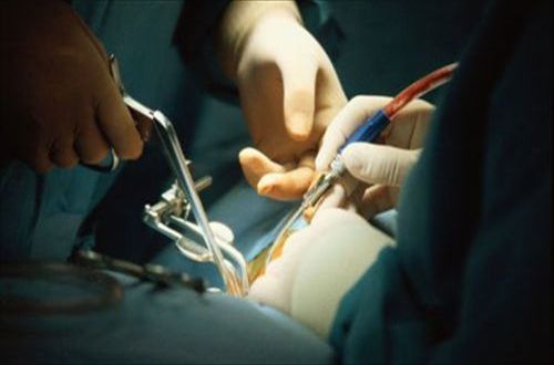 中美STK生育镜技术